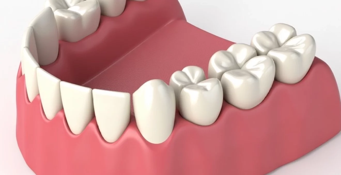 what-a-soft-reline-is-for-immediate-dentures