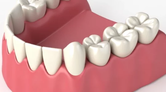 what-a-soft-reline-is-for-immediate-dentures
