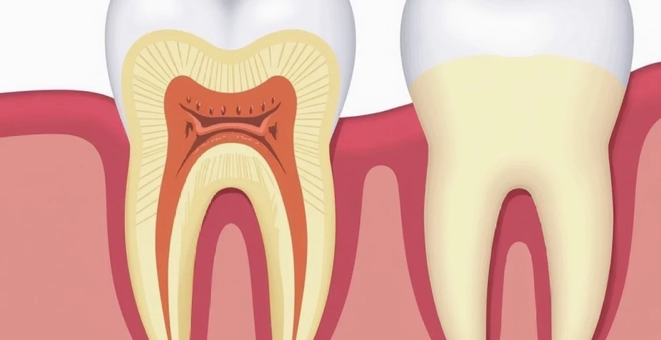 apicoectomy-is-pain-after-one-week-normal